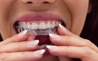 Invisalign St. Paul: Clear Aligner Therapy for Discreet Orthodontic Correction